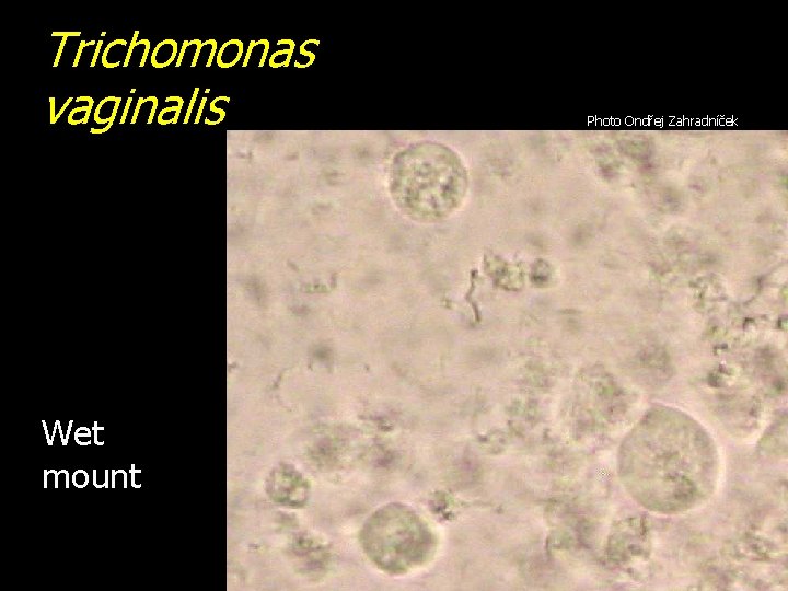 Trichomonas vaginalis Wet mount Photo Ondřej Zahradníček 