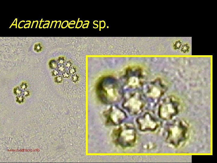 Acantamoeba sp. www. medmicro. info 