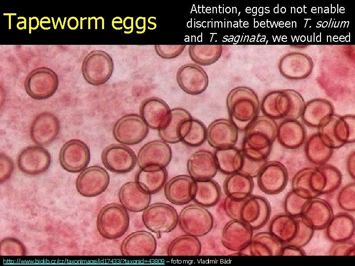 Tapeworm eggs Attention, eggs do not enable discriminate between T. solium and T. saginata,