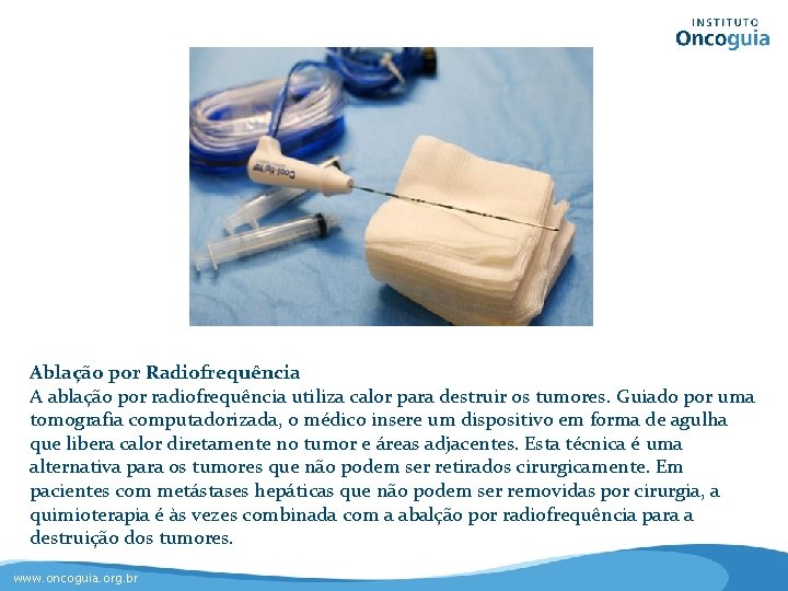 Ablação por Radiofrequência A ablação por radiofrequência utiliza calor para destruir os tumores. Guiado