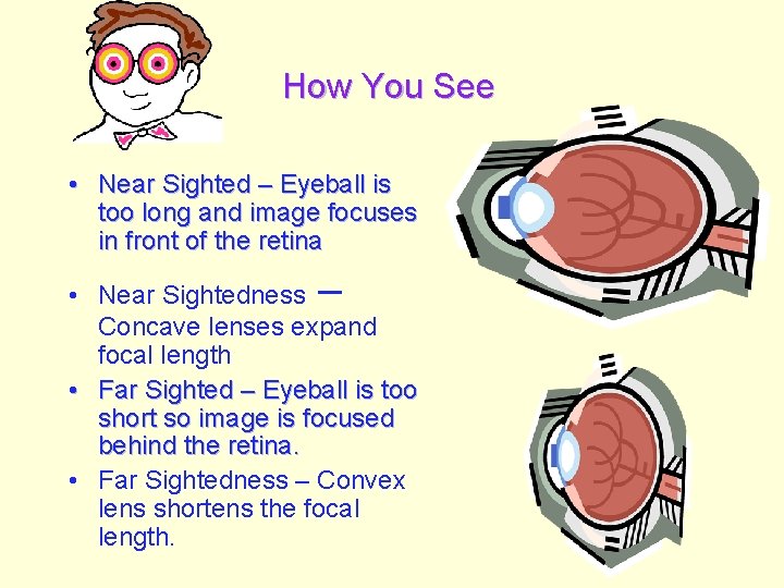 How You See • Near Sighted – Eyeball is too long and image focuses