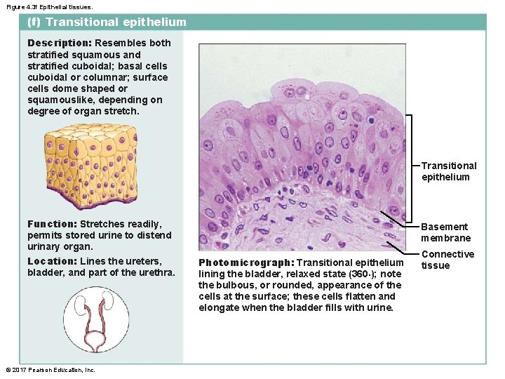 Figure 4. 3 f Epithelial tissues. Transitional epithelium Description: Resembles both stratified squamous and