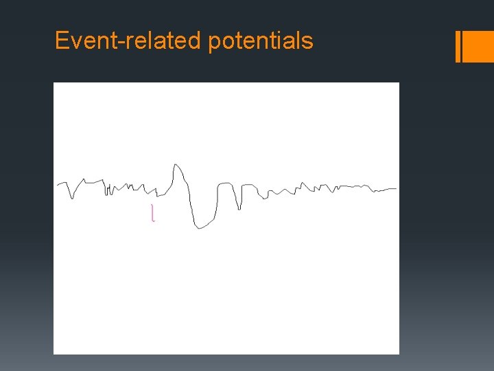 Event-related potentials 