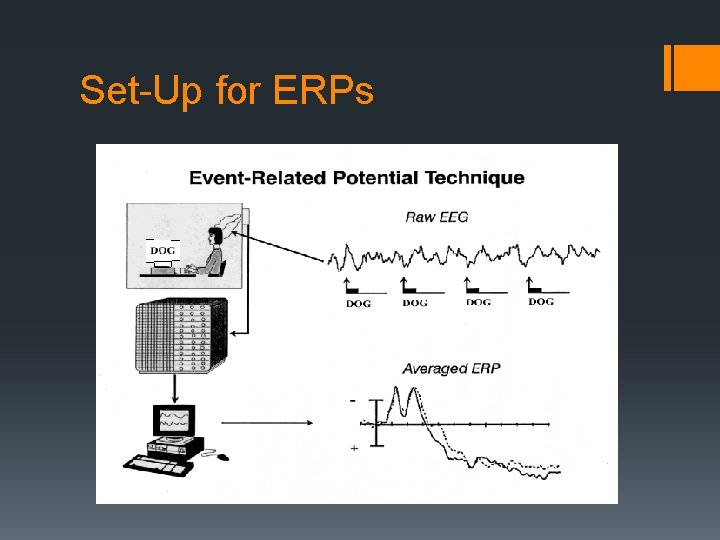 Set-Up for ERPs 