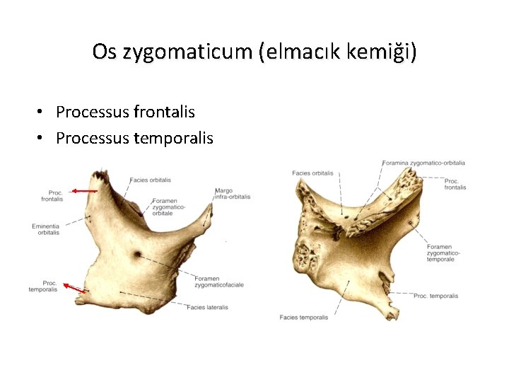 Os zygomaticum (elmacık kemiği) • Processus frontalis • Processus temporalis 
