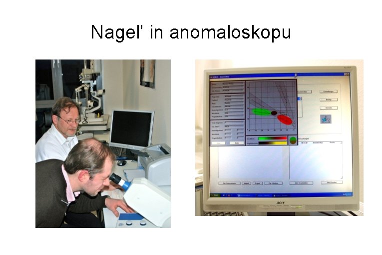 Nagel’ in anomaloskopu 