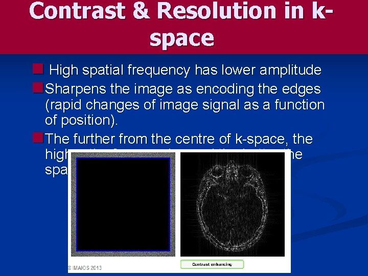 Contrast & Resolution in kspace n High spatial frequency has lower amplitude n Sharpens