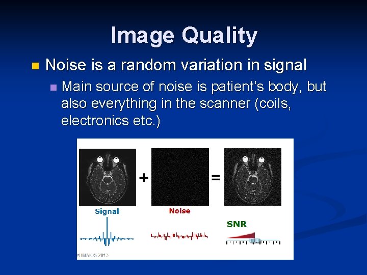 Image Quality n Noise is a random variation in signal n Main source of