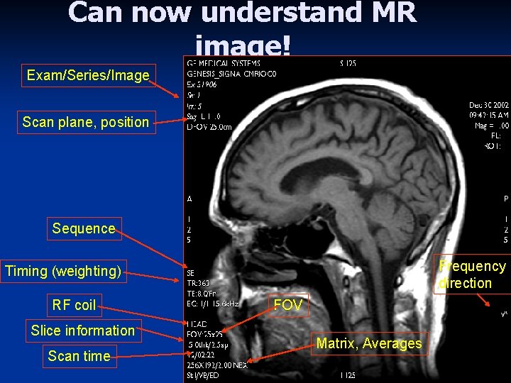 Can now understand MR image! Exam/Series/Image Scan plane, position Sequence Frequency direction Timing (weighting)