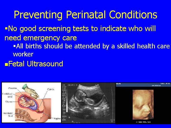 Preventing Perinatal Conditions §No good screening tests to indicate who will need emergency care