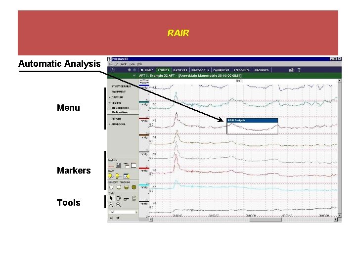 RAIR Automatic Analysis Menu Markers Tools 