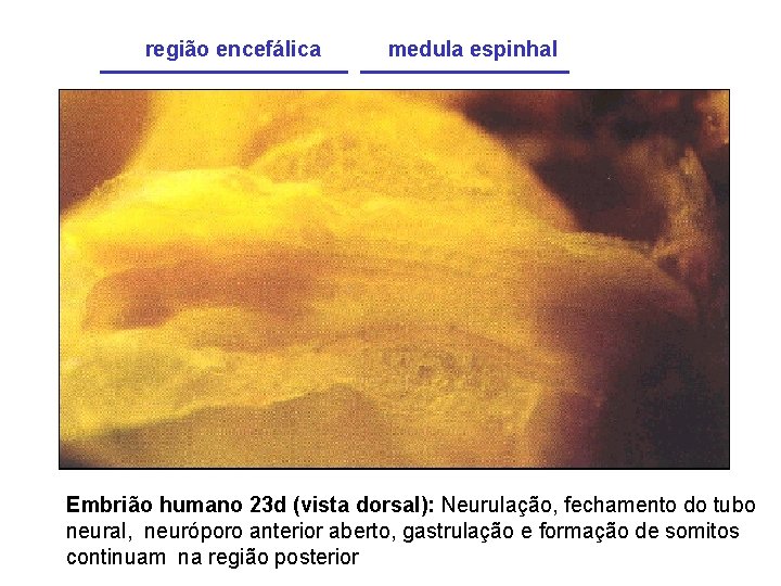 região encefálica medula espinhal Embrião humano 23 d (vista dorsal): Neurulação, fechamento do tubo