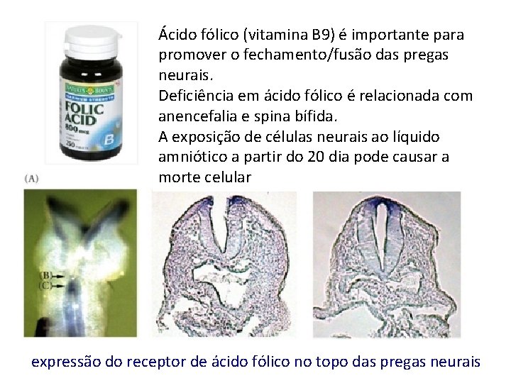 Ácido fólico (vitamina B 9) é importante para promover o fechamento/fusão das pregas neurais.