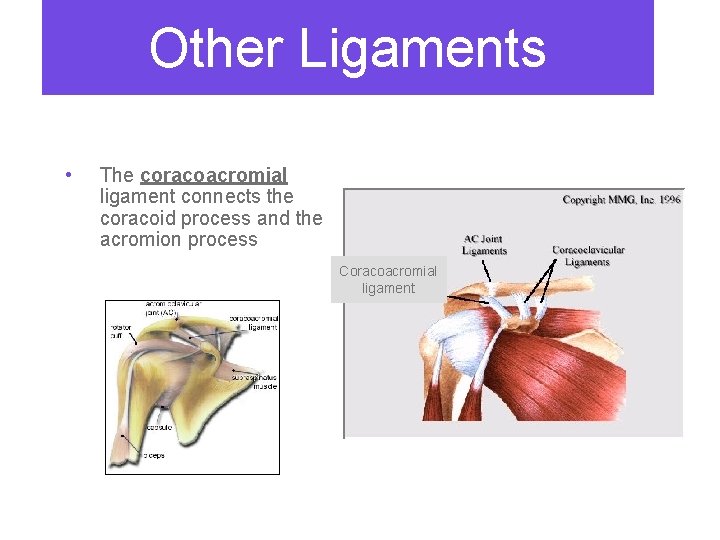 Other Ligaments • The coracoacromial ligament connects the coracoid process and the acromion process
