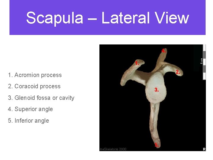 Scapula – Lateral View 4. 1. 2. 1. Acromion process 2. Coracoid process 3.