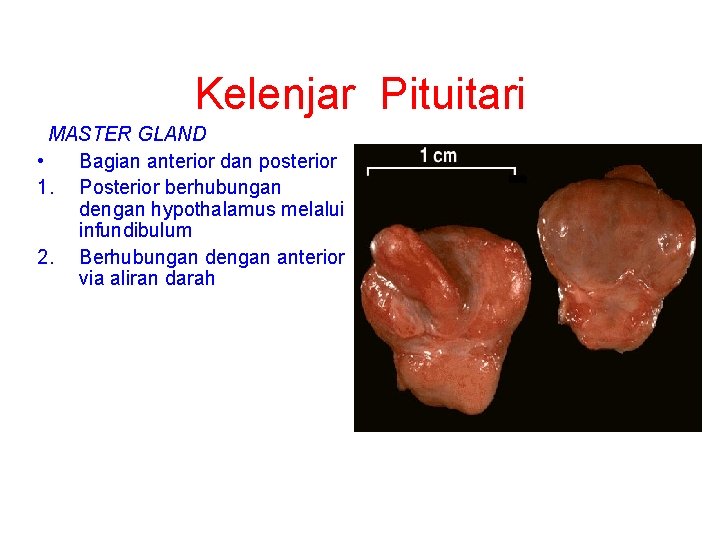 Kelenjar Pituitari MASTER GLAND • Bagian anterior dan posterior 1. Posterior berhubungan dengan hypothalamus