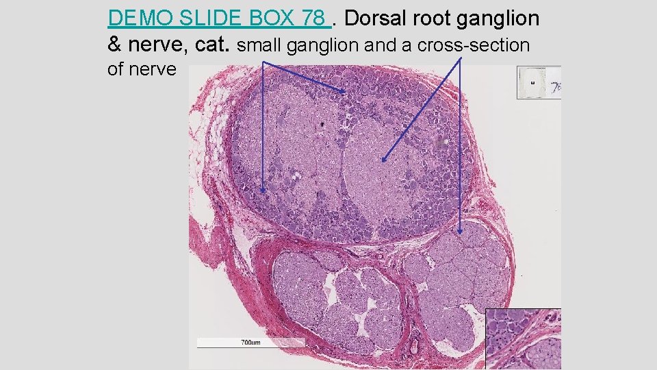 DEMO SLIDE BOX 78. Dorsal root ganglion & nerve, cat. small ganglion and a