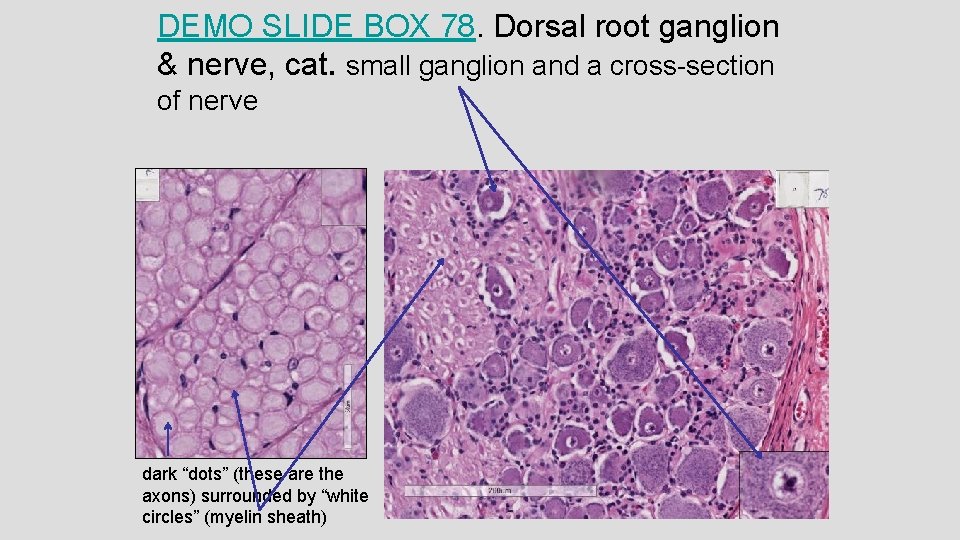 DEMO SLIDE BOX 78. Dorsal root ganglion & nerve, cat. small ganglion and a