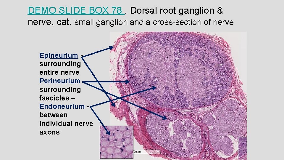 DEMO SLIDE BOX 78. Dorsal root ganglion & nerve, cat. small ganglion and a