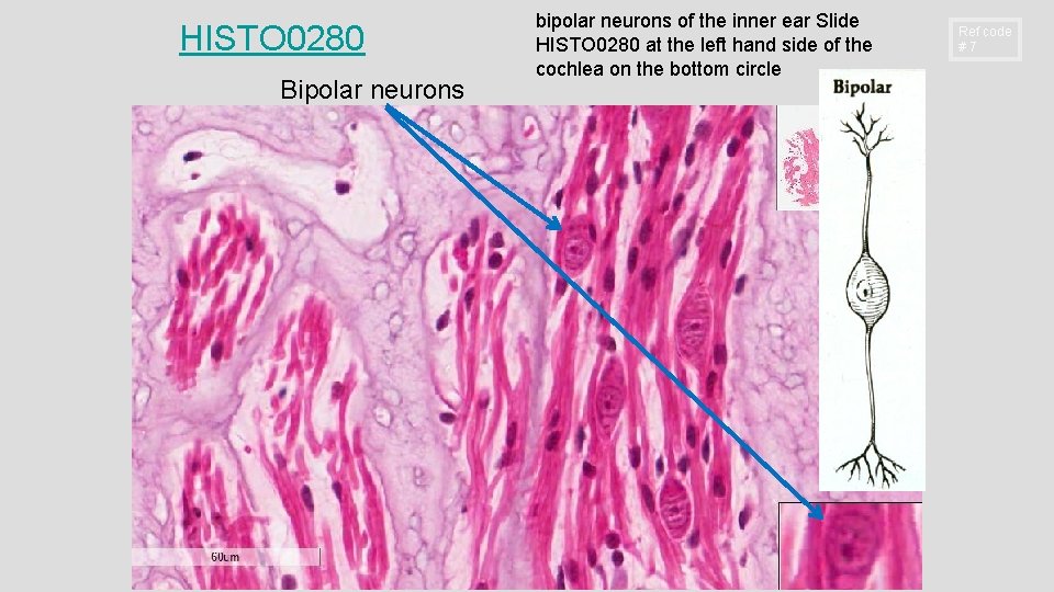 HISTO 0280 Bipolar neurons bipolar neurons of the inner ear Slide HISTO 0280 at