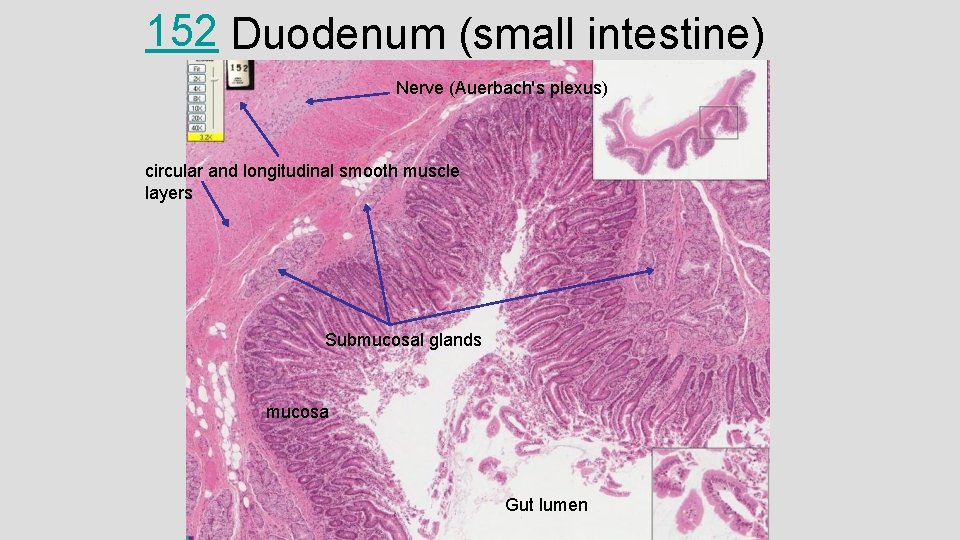 152 Duodenum (small intestine) Nerve (Auerbach's plexus) circular and longitudinal smooth muscle layers Submucosal
