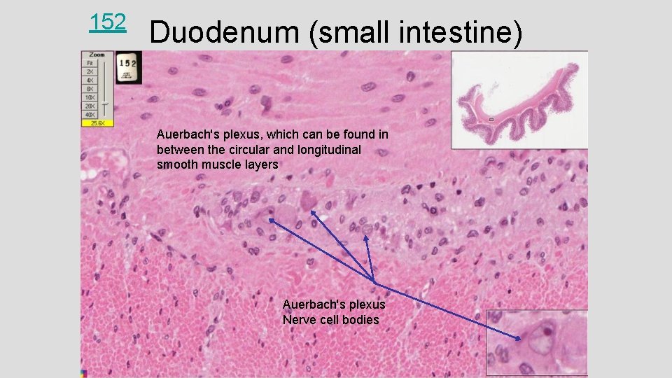 152 Duodenum (small intestine) Auerbach's plexus, which can be found in between the circular