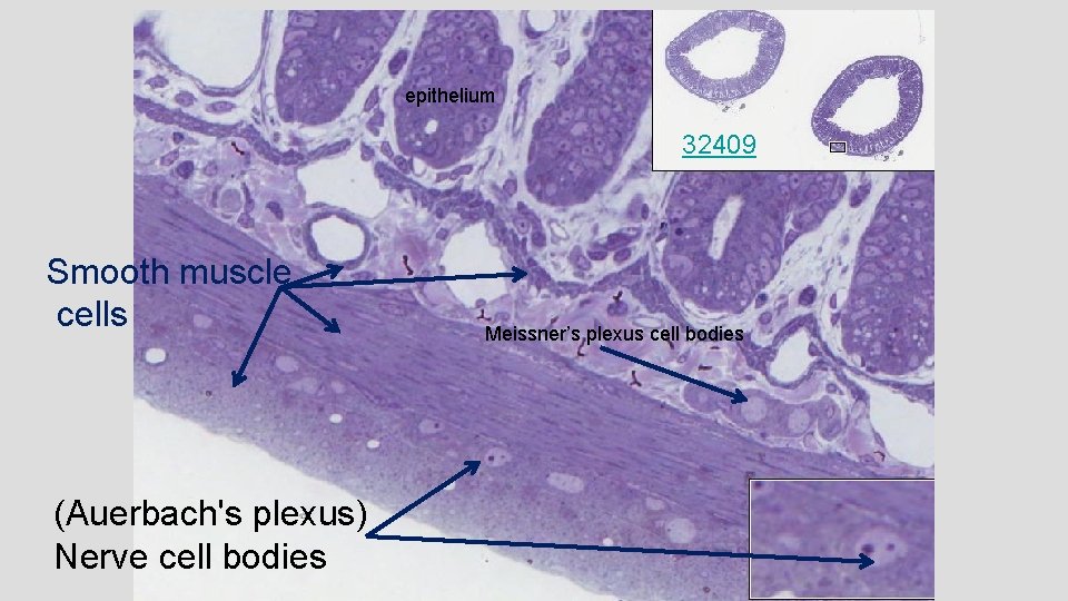 epithelium 32409 Smooth muscle cells (Auerbach's plexus) Nerve cell bodies Meissner’s plexus cell bodies