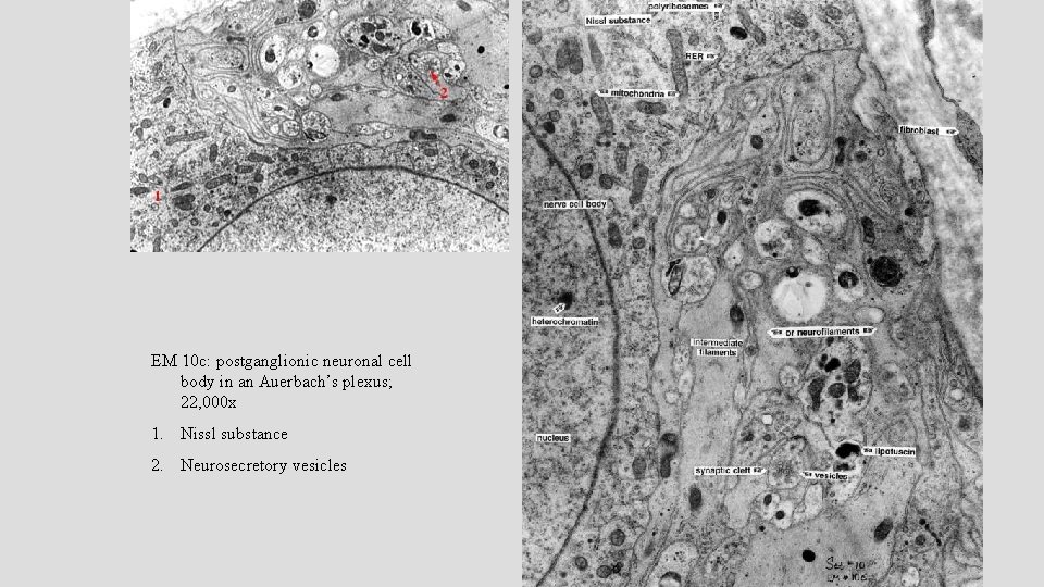 EM 10 c: postganglionic neuronal cell body in an Auerbach’s plexus; 22, 000 x