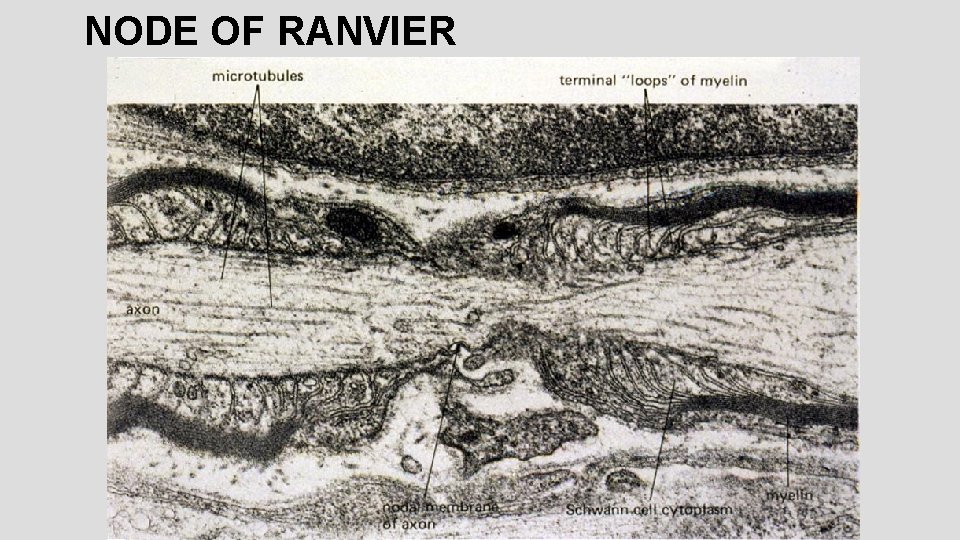 NODE OF RANVIER 
