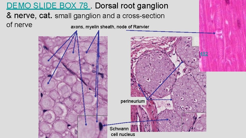 DEMO SLIDE BOX 78. Dorsal root ganglion & nerve, cat. small ganglion and a