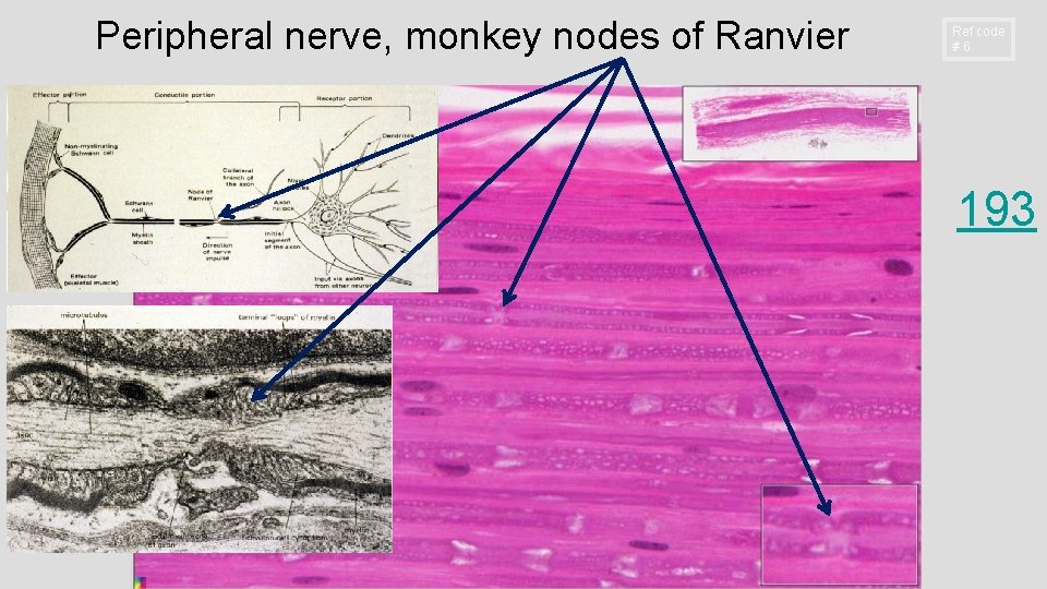 Peripheral nerve, monkey nodes of Ranvier Ref code #6 193 