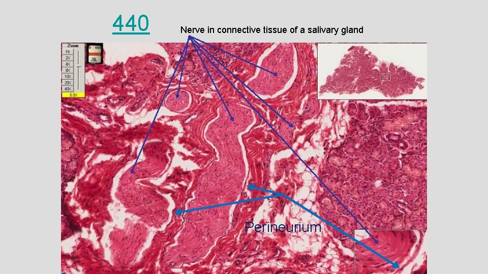 440 Nerve in connective tissue of a salivary gland Perineurium 