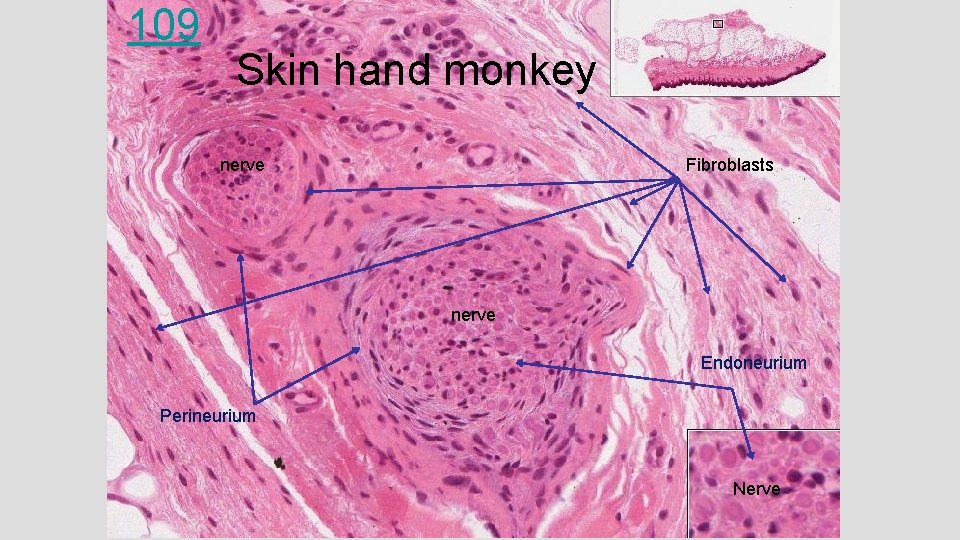 109 Skin hand monkey nerve Fibroblasts nerve Endoneurium Perineurium Nerve 