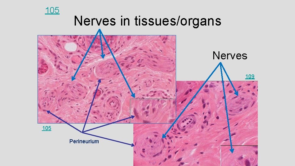105 Nerves in tissues/organs Nerves 109 105 Perineurium 