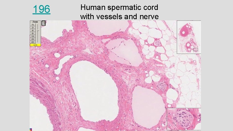196 Human spermatic cord with vessels and nerve 