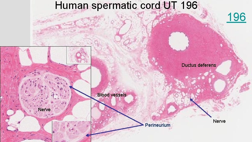 Human spermatic cord UT 196 Ductus deferens Blood vessels Nerve Perineurium Nerve 