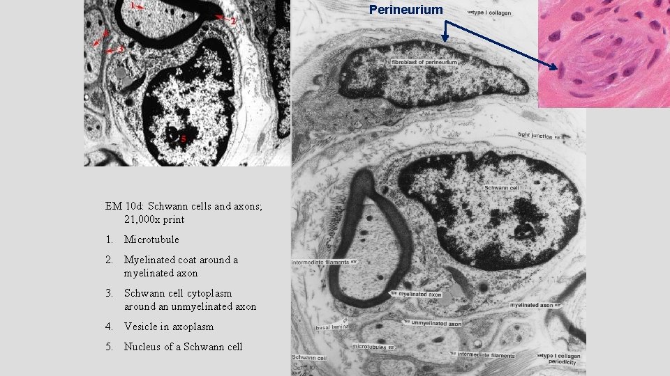 Perineurium EM 10 d: Schwann cells and axons; 21, 000 x print 1. Microtubule