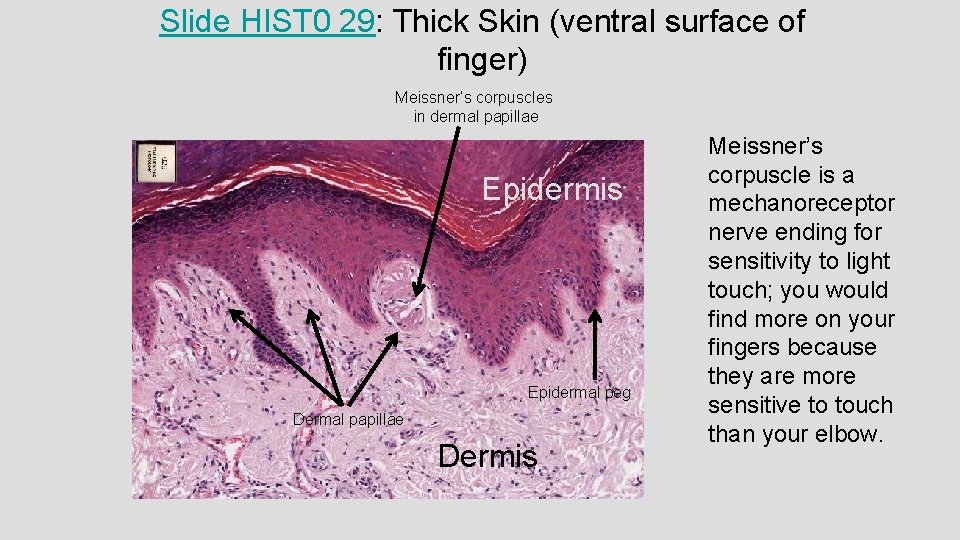 Slide HIST 0 29: Thick Skin (ventral surface of finger) Meissner’s corpuscles in dermal