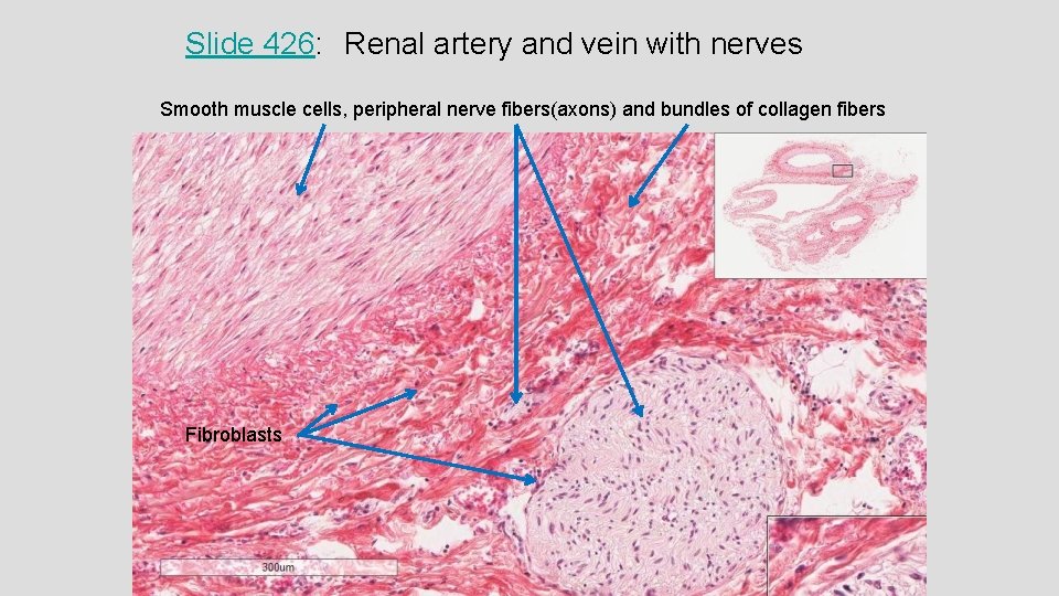 Slide 426: Renal artery and vein with nerves Smooth muscle cells, peripheral nerve fibers(axons)