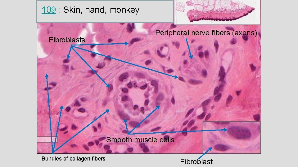 109 : Skin, hand, monkey Fibroblasts Peripheral nerve fibers (axons) Smooth muscle cells Bundles