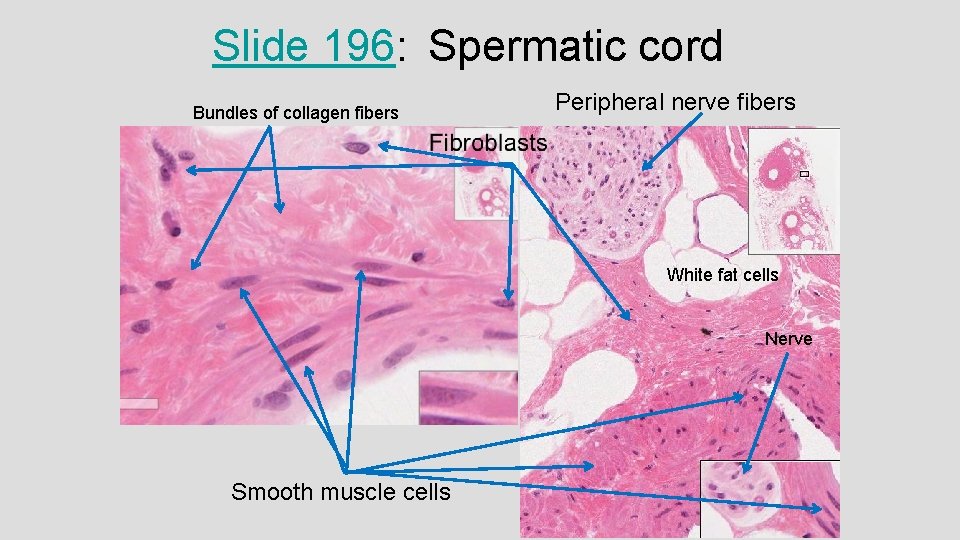 Slide 196: Spermatic cord Bundles of collagen fibers Peripheral nerve fibers White fat cells