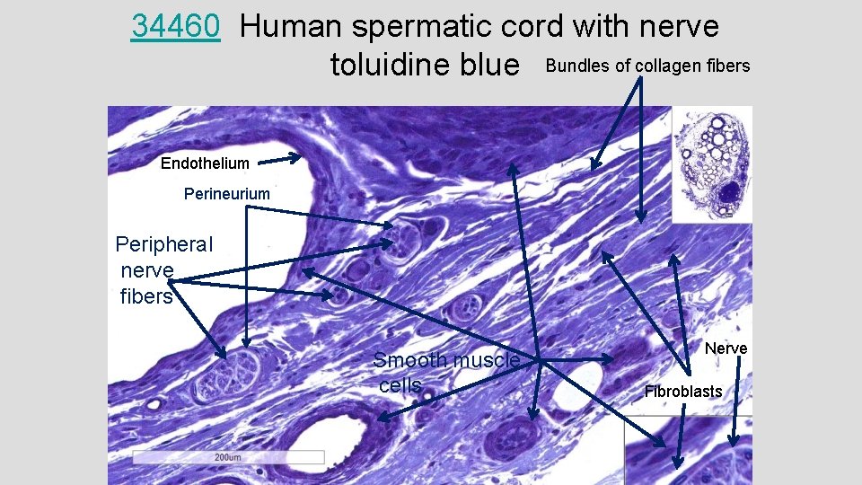 34460 Human spermatic cord with nerve toluidine blue Bundles of collagen fibers Endothelium Perineurium