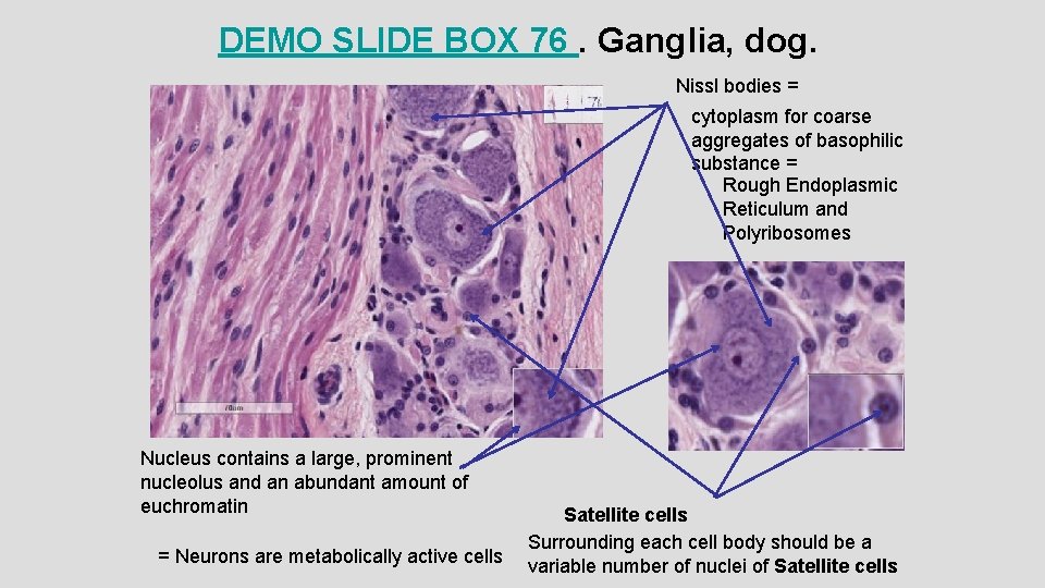 DEMO SLIDE BOX 76. Ganglia, dog. Nissl bodies = cytoplasm for coarse aggregates of