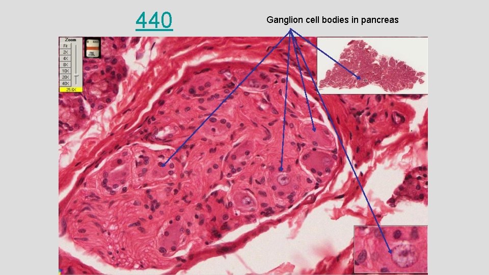 440 Ganglion cell bodies in pancreas 