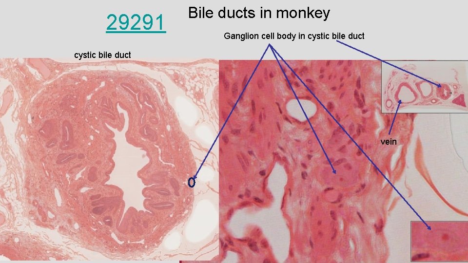 29291 Bile ducts in monkey Ganglion cell body in cystic bile duct vein 