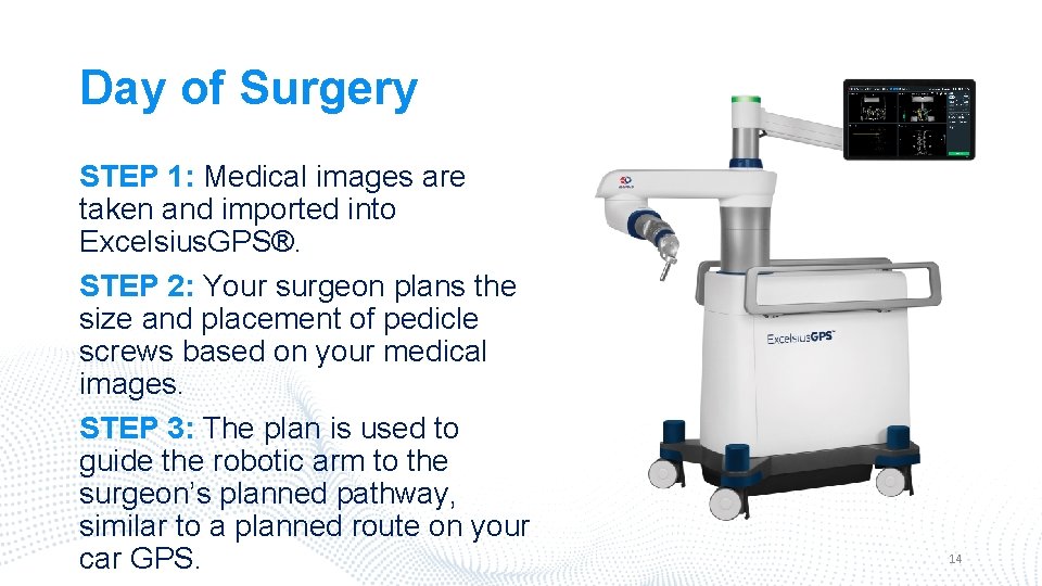 Day of Surgery STEP 1: Medical images are taken and imported into Excelsius. GPS®.