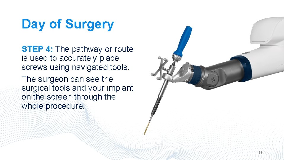 Day of Surgery STEP 4: The pathway or route is used to accurately place