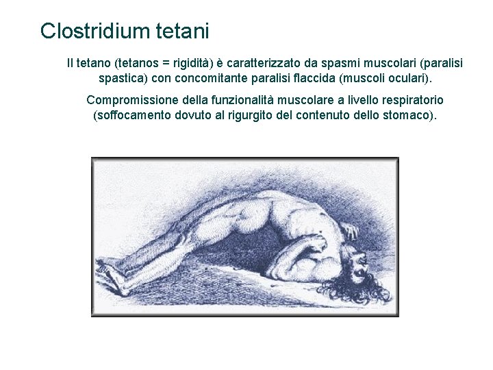 Clostridium tetani Il tetano (tetanos = rigidità) è caratterizzato da spasmi muscolari (paralisi spastica)