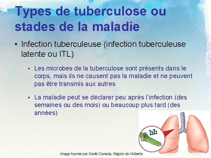 Types de tuberculose ou stades de la maladie • Infection tuberculeuse (infection tuberculeuse latente