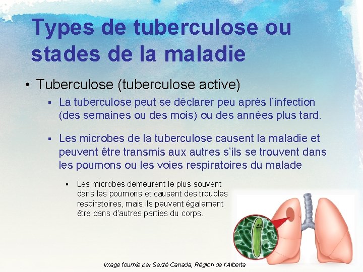Types de tuberculose ou stades de la maladie • Tuberculose (tuberculose active) § La